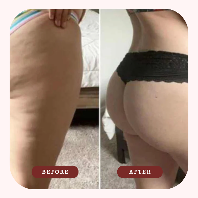 Cellulite Sculpting Oil