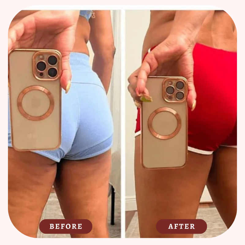 Cellulite Sculpting Oil