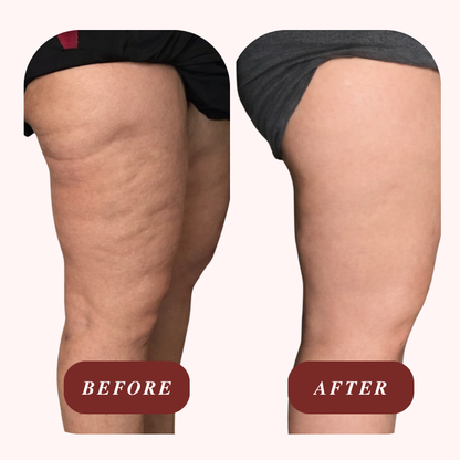 Cellulite Sculpting Oil